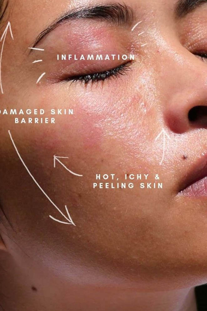 Can I use Retinol and Tretinoin Together? Tips & Routine - Natalie O'Neill  Blog