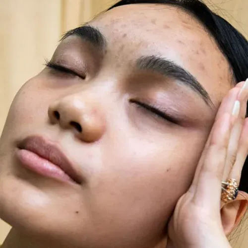 Close-up of a woman with clear skin and natural glow, relaxing with eyes closed.